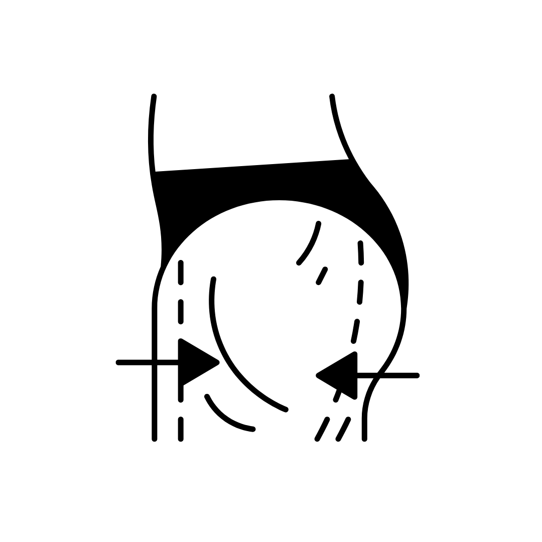 Jowling